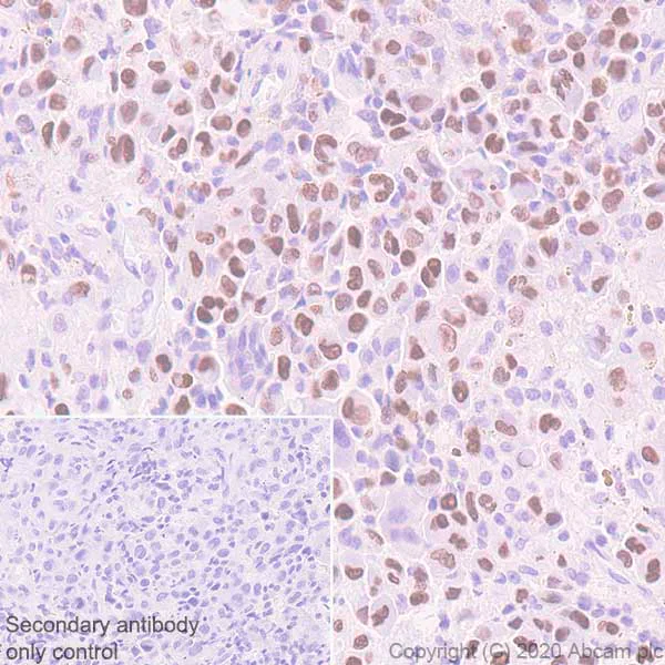 Immunohistochemistry (Formalin/PFA-fixed paraffin-embedded sections) - Anti-Histone H3 (mutated K36M) antibody [EPR23614-91] (AB256384)