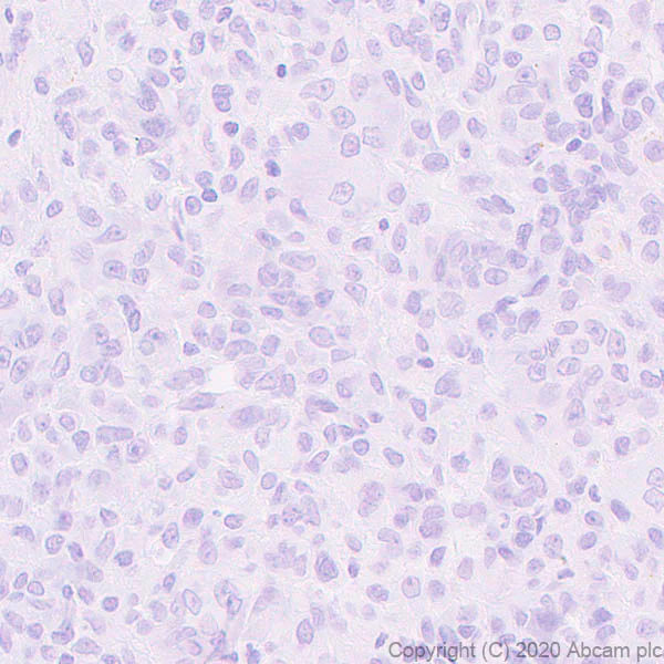 Immunohistochemistry (Formalin/PFA-fixed paraffin-embedded sections) - Anti-Histone H3 (mutated K36M) antibody [EPR23614-91] - BSA and Azide free (AB270796)