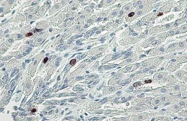 Immunohistochemistry (Formalin/PFA-fixed paraffin-embedded sections) - Anti-Histone H3 (phospho S10) antibody (AB183626)
