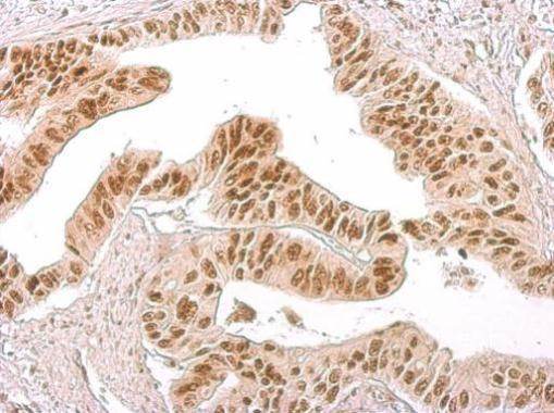 Immunohistochemistry (Formalin/PFA-fixed paraffin-embedded sections) - Anti-Histone H3 (phospho S10) antibody (AB183626), expandable thumbnail
