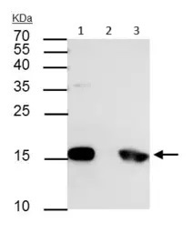 Immunoprecipitation - Anti-Histone H3 (phospho S10) antibody (AB183626)