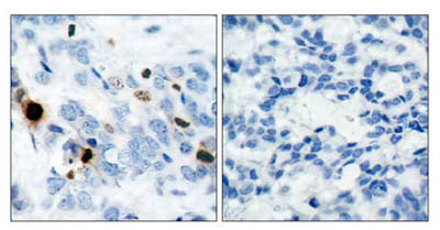 Immunohistochemistry (Formalin/PFA-fixed paraffin-embedded sections) - Anti-Histone H3 (phospho S10) antibody (AB47297)