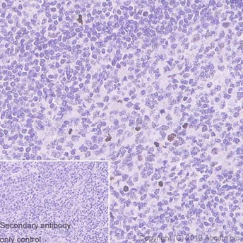 Immunohistochemistry (Formalin/PFA-fixed paraffin-embedded sections) - Anti-Histone H3 (phospho S10) antibody [EPR17246] - BSA and Azide free (AB239405), expandable thumbnail