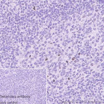 Immunohistochemistry (Formalin/PFA-fixed paraffin-embedded sections) - Anti-Histone H3 (phospho S10) antibody [EPR17246] - BSA and Azide free (AB239405)