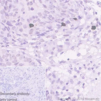 Immunohistochemistry (Formalin/PFA-fixed paraffin-embedded sections) - Anti-Histone H3 (phospho S10) antibody [EPR17246] - BSA and Azide free (AB239405)