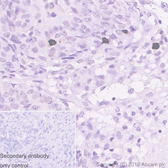 Immunohistochemistry (Formalin/PFA-fixed paraffin-embedded sections) - Anti-Histone H3 (phospho S10) antibody [EPR17246] - ChIP Grade (AB177218)