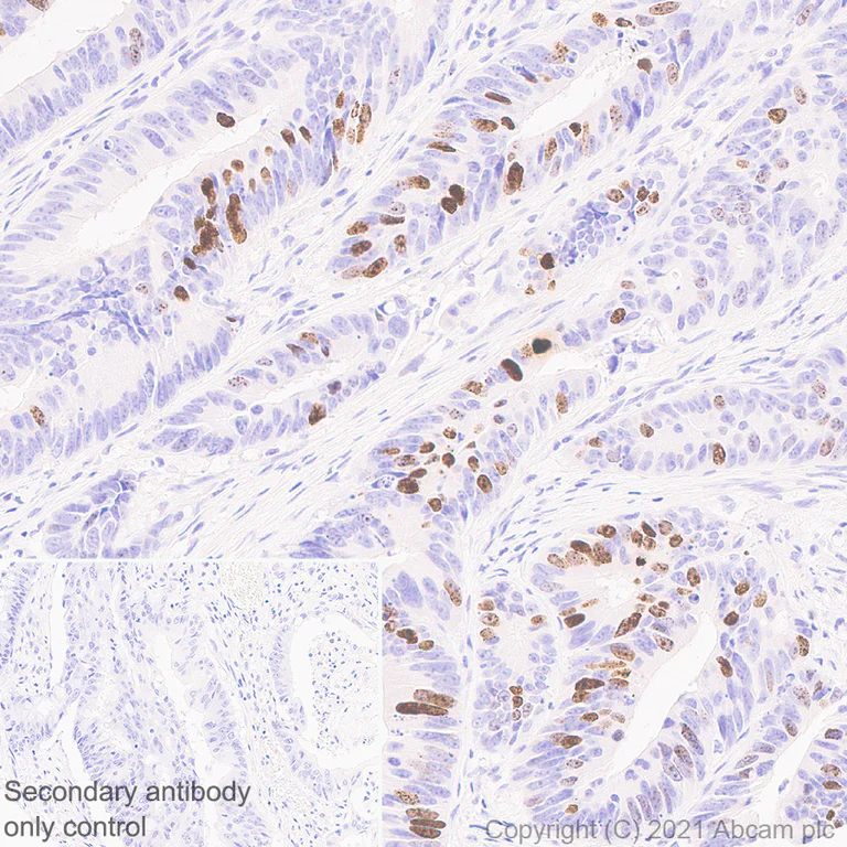 Immunohistochemistry (Formalin/PFA-fixed paraffin-embedded sections) - Anti-Histone H3 (phospho S10) antibody [EPR24060-36] (AB267372)