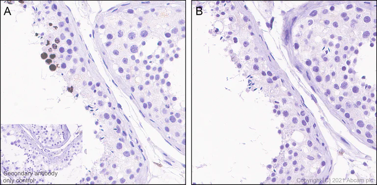 Immunohistochemistry (Formalin/PFA-fixed paraffin-embedded sections) - Anti-Histone H3 (phospho S10) antibody [EPR24060-36] - BSA and Azide free (AB282284)