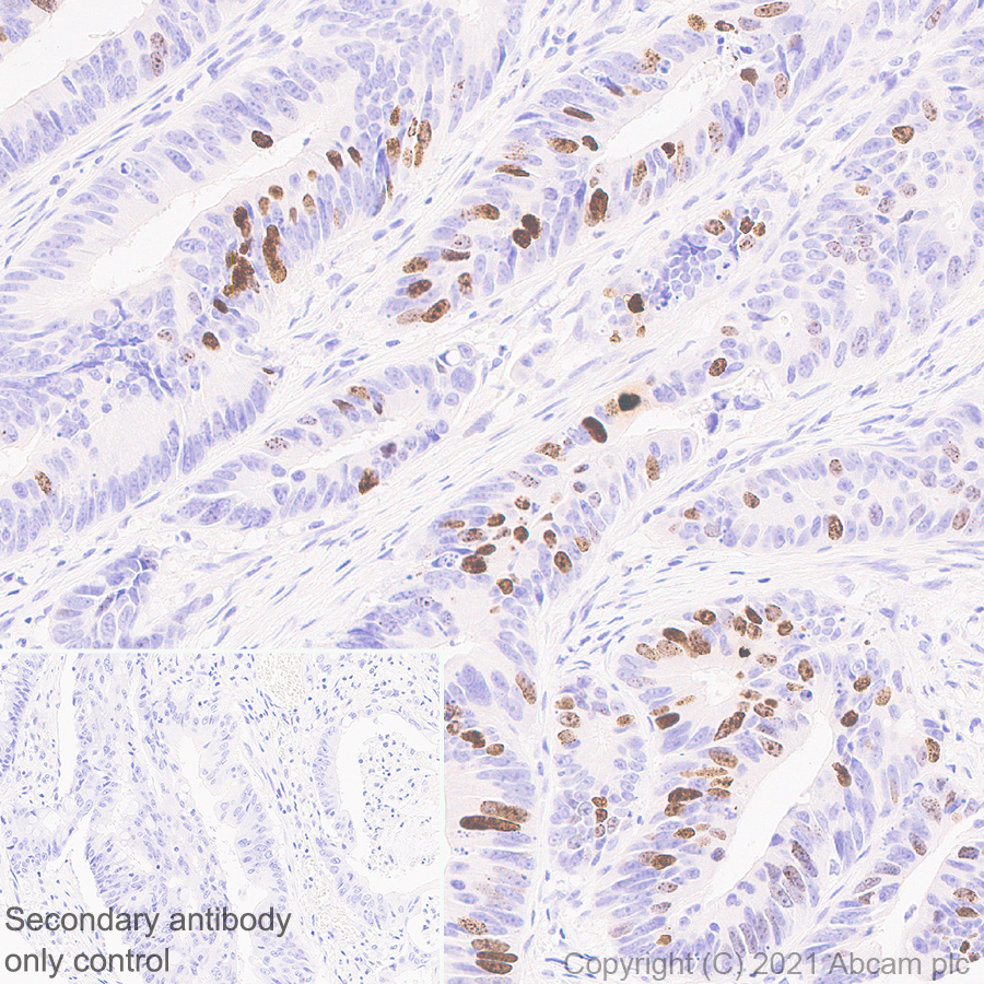 Immunohistochemistry (Formalin/PFA-fixed paraffin-embedded sections) - Anti-Histone H3 (phospho S10) antibody [EPR24060-36] - BSA and Azide free (AB282284), expandable thumbnail