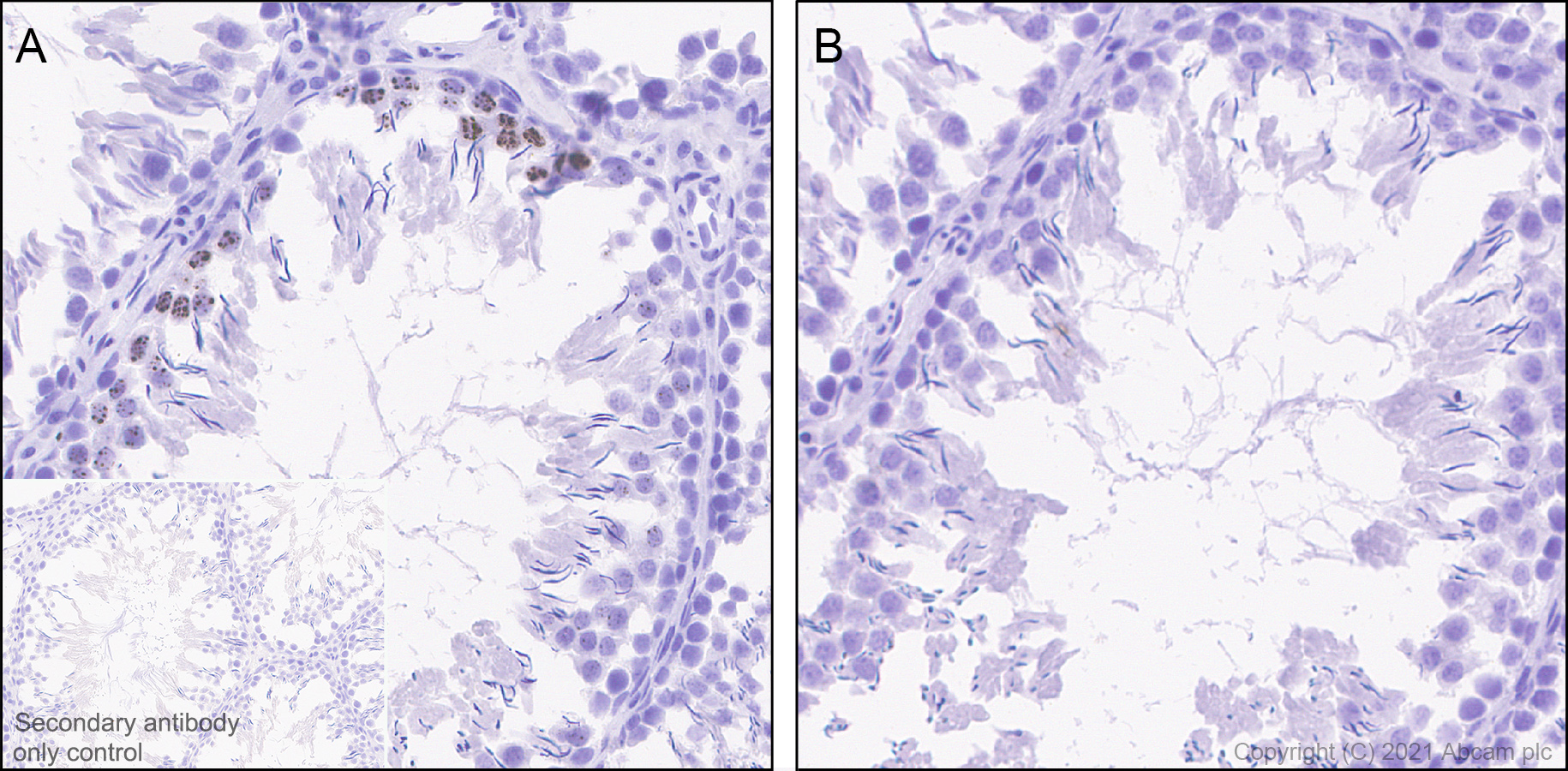 Immunohistochemistry (Formalin/PFA-fixed paraffin-embedded sections) - Anti-Histone H3 (phospho S10) antibody [EPR24060-36] - BSA and Azide free (ab282284), expandable thumbnail