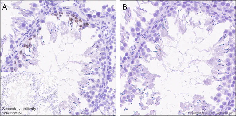 Immunohistochemistry (Formalin/PFA-fixed paraffin-embedded sections) - Anti-Histone H3 (phospho S10) antibody [EPR24060-36] - BSA and Azide free (AB282284)