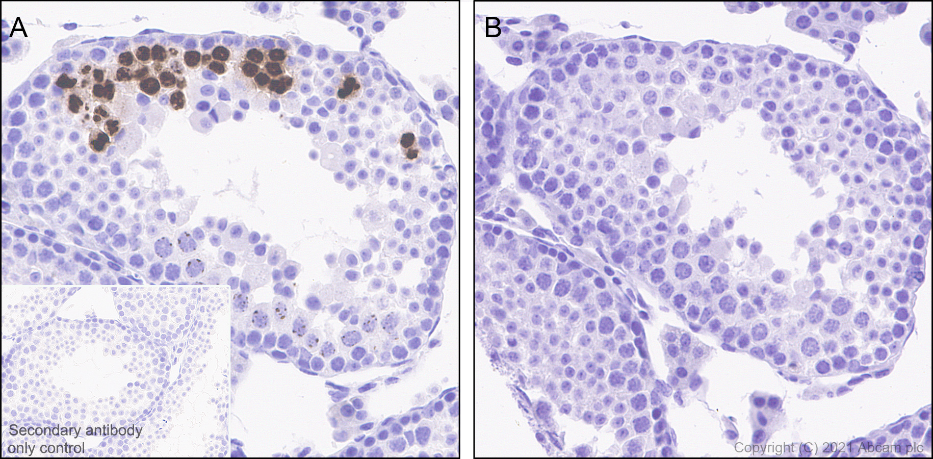 Immunohistochemistry (Formalin/PFA-fixed paraffin-embedded sections) - Anti-Histone H3 (phospho S10) antibody [EPR24060-36] - BSA and Azide free (ab282284), expandable thumbnail