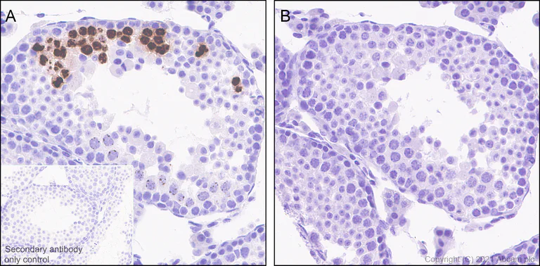 Immunohistochemistry (Formalin/PFA-fixed paraffin-embedded sections) - Anti-Histone H3 (phospho S10) antibody [EPR24060-36] - BSA and Azide free (AB282284)