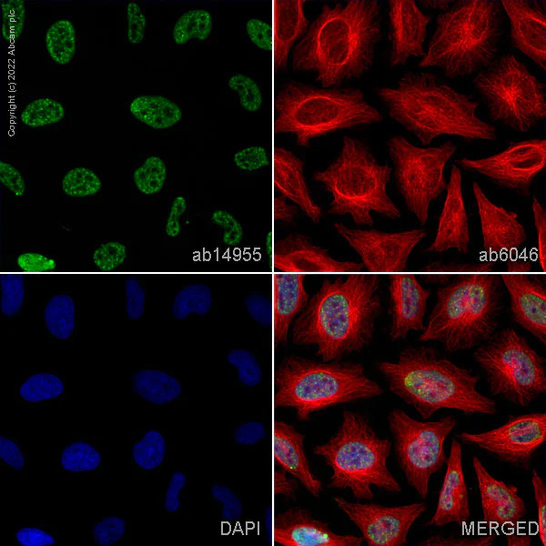 Immunocytochemistry/ Immunofluorescence - Anti-Histone H3 (phospho S10) antibody [mAbcam 14955] (AB14955)