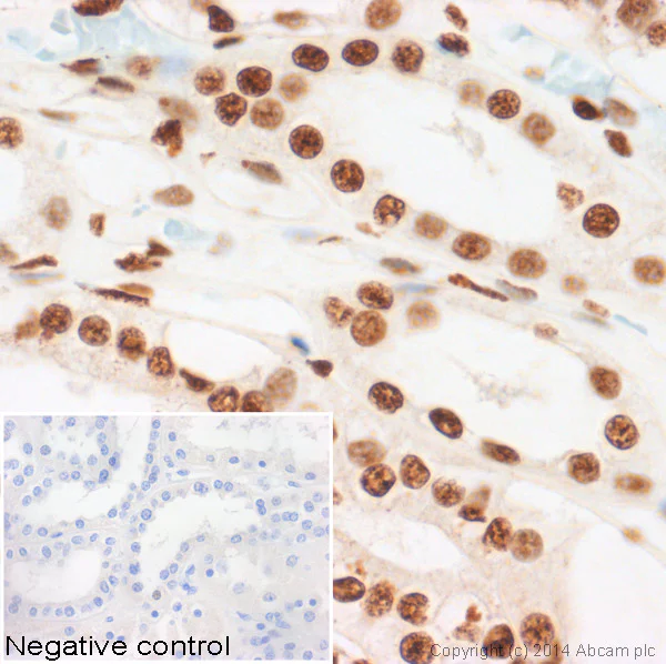 Immunohistochemistry (Formalin/PFA-fixed paraffin-embedded sections) - Anti-Histone H3 (phospho S10) antibody [mAbcam 14955] (AB14955)