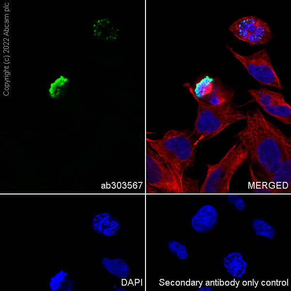 Immunocytochemistry/ Immunofluorescence - Anti-Histone H3 (phospho S10 + S28) antibody [RM1046] (AB303567)