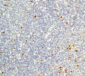 Immunohistochemistry (Formalin/PFA-fixed paraffin-embedded sections) - Anti-Histone H3 (phospho S10 + T11) antibody [E173] - BSA and Azide free (AB239803)