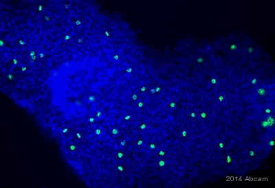 Anti-Histone H3 (phospho S28) antibody [HTA28]