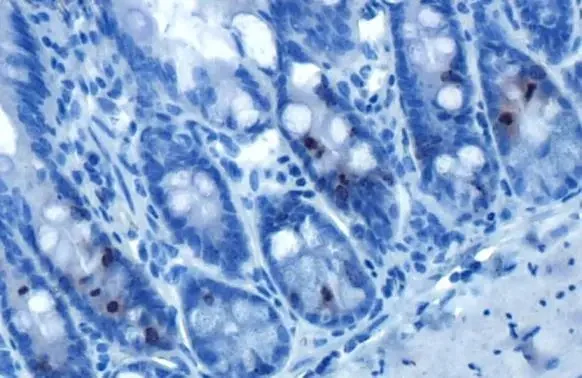 Immunohistochemistry (Formalin/PFA-fixed paraffin-embedded sections) - Anti-Histone H3 (phospho Ser10) antibody [HL1752] (AB308373)