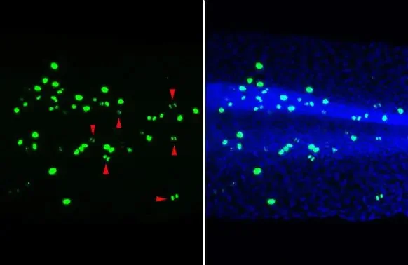 Immunohistochemistry (Formalin/PFA-fixed paraffin-embedded sections) - Anti-Histone H3 (phospho Ser10) antibody [HL1752] (AB308373)