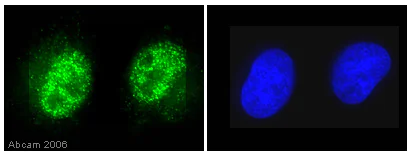 Immunocytochemistry/ Immunofluorescence - Anti-Histone H3 (phospho T11) antibody (AB5168)