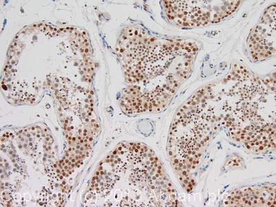 Immunohistochemistry (Formalin/PFA-fixed paraffin-embedded sections) - Anti-Histone H3 (phospho T11) antibody (AB5168)
