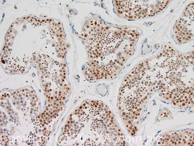 Immunohistochemistry (Formalin/PFA-fixed paraffin-embedded sections) - Anti-Histone H3 (phospho T11) antibody (AB5168)