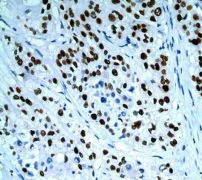 Immunohistochemistry (Formalin/PFA-fixed paraffin-embedded sections) - Anti-Histone H3 (phospho T3) antibody [EP1702Y] - BSA and Azide free (AB247494)
