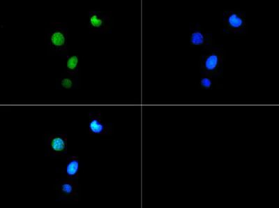 Immunocytochemistry/ Immunofluorescence - Anti-Histone H3 (phospho T6, tri methyl K9) antibody (AB272147)