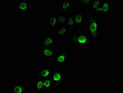 Immunocytochemistry/ Immunofluorescence - Anti-Histone H3 (propionyl K23) antibody (AB241466)