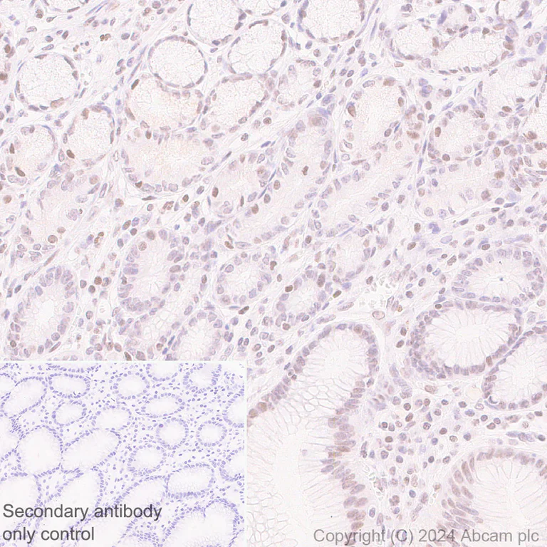 Immunohistochemistry (Formalin/PFA-fixed paraffin-embedded sections) - Anti-Histone H3 (propionyl K23) antibody [EPR28672-86] (AB317819)
