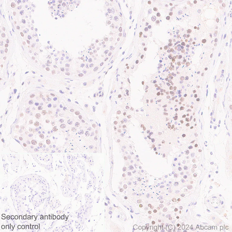 Immunohistochemistry (Formalin/PFA-fixed paraffin-embedded sections) - Anti-Histone H3 (propionyl K23) antibody [EPR28672-86] (AB317819)