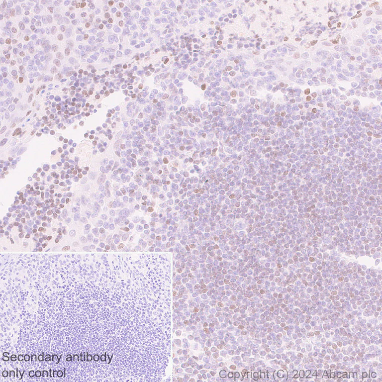 Immunohistochemistry (Formalin/PFA-fixed paraffin-embedded sections) - Anti-Histone H3 (propionyl K23) antibody [EPR28672-86] - BSA and Azide free (AB317820)