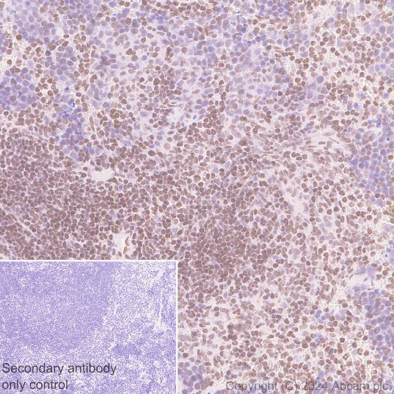 Immunohistochemistry (Formalin/PFA-fixed paraffin-embedded sections) - Anti-Histone H3 (propionyl K23) antibody [EPR28672-86] - BSA and Azide free (AB317820)