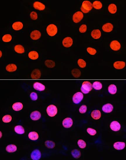Immunocytochemistry/ Immunofluorescence - Anti-Histone H3 (symmetric di methyl R2) antibody (AB194684)