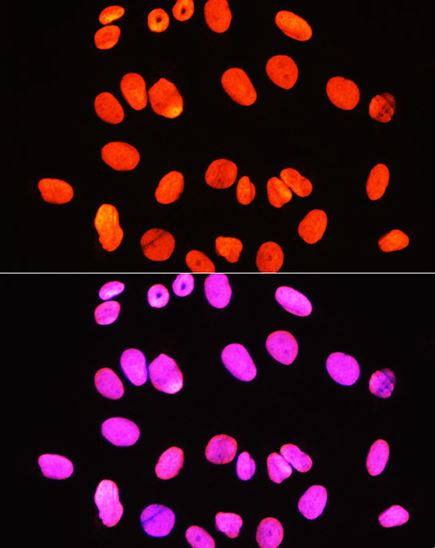 Immunocytochemistry/ Immunofluorescence - Anti-Histone H3 (symmetric di methyl R2) antibody (AB194684)