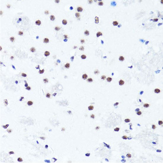 Immunohistochemistry (Formalin/PFA-fixed paraffin-embedded sections) - Anti-Histone H3 (symmetric di methyl R2) antibody (AB194684)