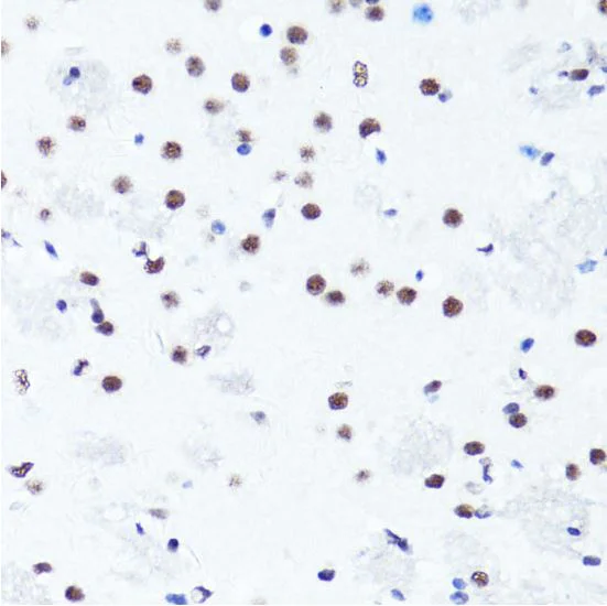 Immunohistochemistry (Formalin/PFA-fixed paraffin-embedded sections) - Anti-Histone H3 (symmetric di methyl R2) antibody (AB194684)
