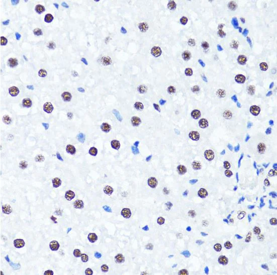 Immunohistochemistry (Formalin/PFA-fixed paraffin-embedded sections) - Anti-Histone H3 (symmetric di methyl R2) antibody (AB194684)