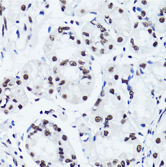 Immunohistochemistry (Formalin/PFA-fixed paraffin-embedded sections) - Anti-Histone H3 (symmetric di methyl R2) antibody (AB194684)