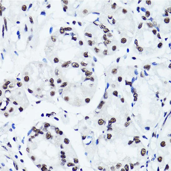 Immunohistochemistry (Formalin/PFA-fixed paraffin-embedded sections) - Anti-Histone H3 (symmetric di methyl R2) antibody (AB194684)