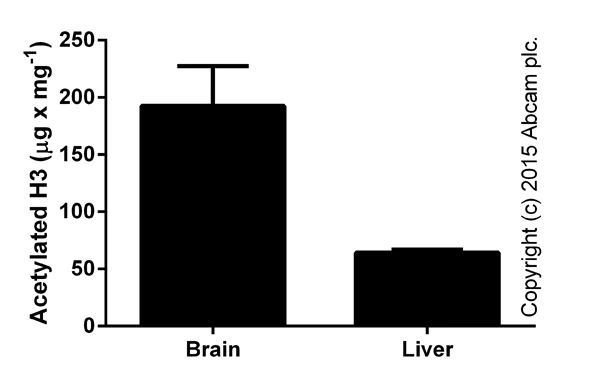 Functional Studies - Histone H3 Total Acetylation Detection Fast Kit (Colorimetric) (AB115124)