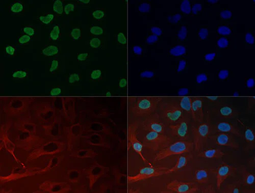 Immunocytochemistry/ Immunofluorescence - Anti-Histone H3 (tri methyl K27) antibody (AB272165)