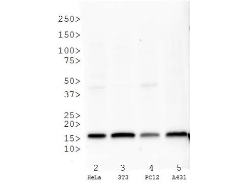 Western blot - Anti-Histone H3 (tri methyl K27) antibody (AB272165)