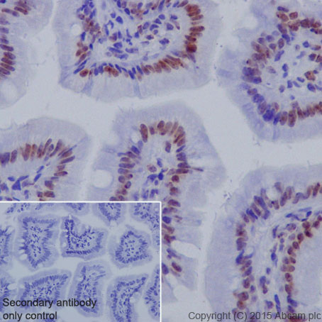 Immunohistochemistry (Formalin/PFA-fixed paraffin-embedded sections) - Anti-Histone H3 (tri methyl K27) antibody [EPR18607] - BSA and Azide free (ab222481), expandable thumbnail