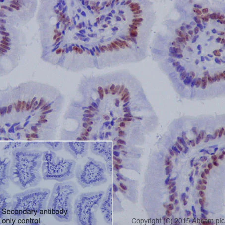 Immunohistochemistry (Formalin/PFA-fixed paraffin-embedded sections) - Anti-Histone H3 (tri methyl K27) antibody [EPR18607] - ChIP Grade (AB192985)