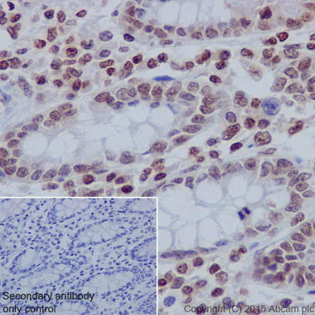 Immunohistochemistry (Formalin/PFA-fixed paraffin-embedded sections) - Anti-Histone H3 (tri methyl K27) antibody [EPR18607] - ChIP Grade (AB192985)