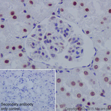 Immunohistochemistry (Formalin/PFA-fixed paraffin-embedded sections) - Anti-Histone H3 (tri methyl K27) antibody [EPR18607] - ChIP Grade (AB192985)