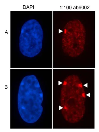 Immunocytochemistry/ Immunofluorescence - Anti-Histone H3 (tri methyl K27) antibody [mAbcam 6002] - ChIP Grade (AB6002)