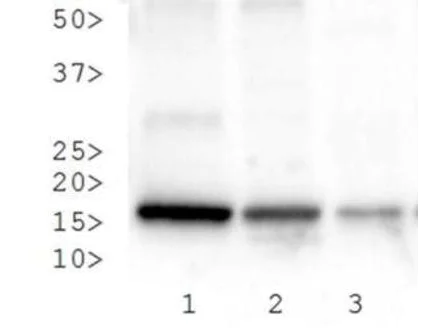 Western blot - Anti-Histone H3 (tri methyl K27, phospho S28) antibody (AB272155)